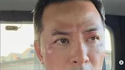 Kim Chang-ok reveals swollen face amid new artistic pursuit