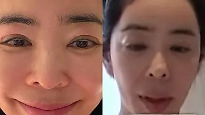 Lee Hye-young Upset Over Eyes No Longer Looking Pretty After 5-Year Battle With Lung Canc…
