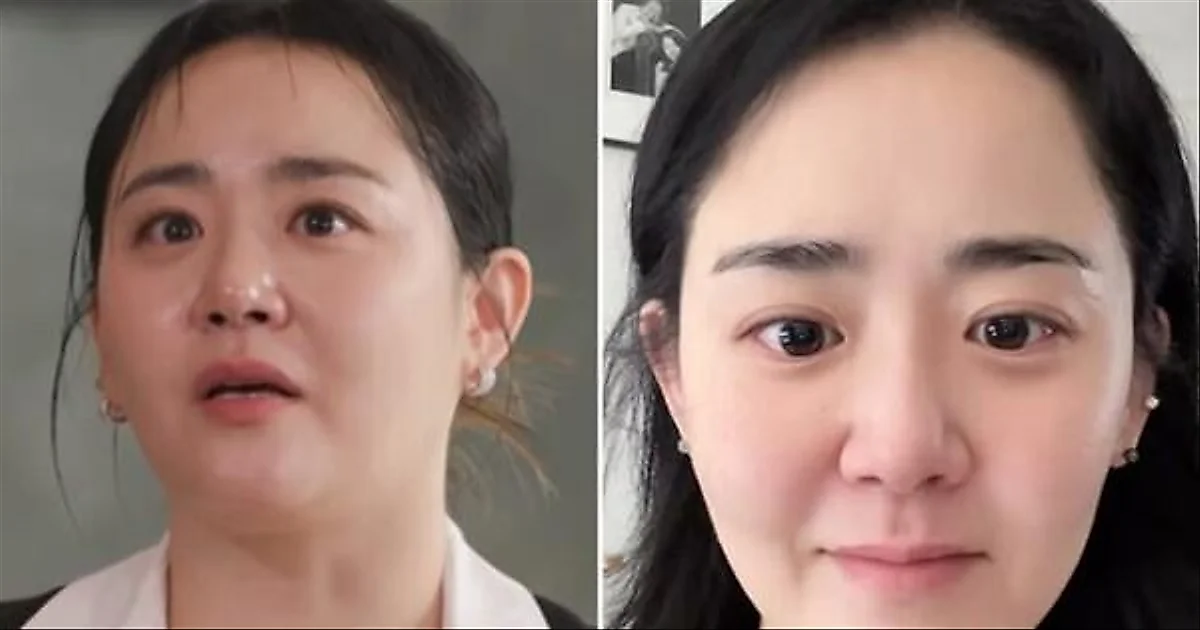 Moon Geun-young reveals slimmer look after weight concerns