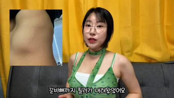 Lee Se-young discusses breast augmentation confidence but advises against it