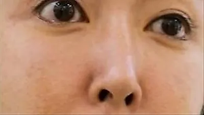 S.E.S. Suga reveals skin concerns on 'Beauty Clinic Touch Me'