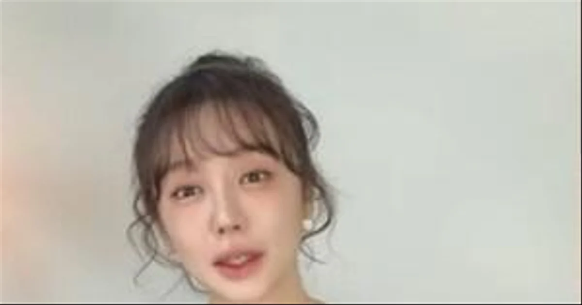 Yoon Eun-hye gặp tình trạng dị ứng nghiêm trọng, chi phí điều trị đắt đỏ