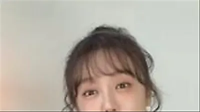 Yoon Eun-hye reveals severe allergic reaction and heavy medical costs