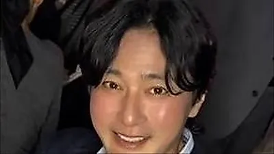 チャン・ドンゴン、顔がどうした？ ふっくら赤みを帯びた赤い姿