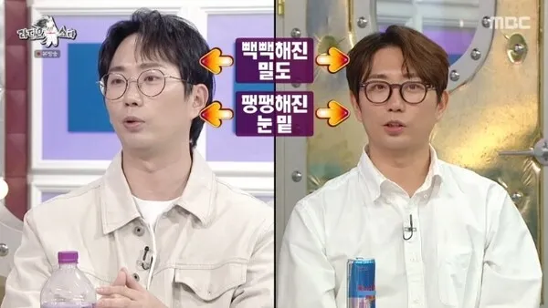 Lee Chang-ho reveals hair transplant and under-eye fat repositioning, says he 'imitated Kim Woo-bin'