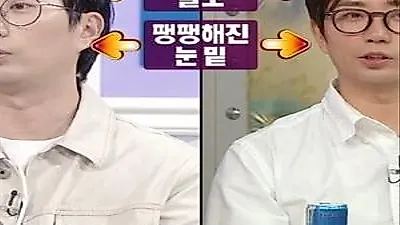 Lee Chang-ho mimics Kim Woo-bin after hair transplant and eye surgery