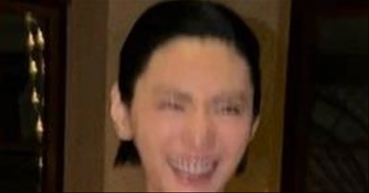 ナナ、唇の変化で再び注目。フィラー論争を経て「元の姿」へ？