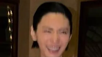 Nana嘴唇变薄引发关注，展现顶级名品美貌