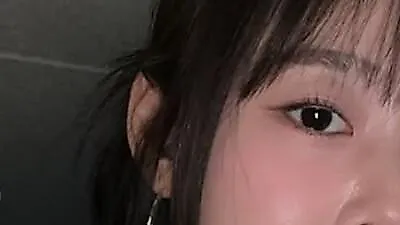 韩昇延带伤坚持完成5首表演，因颈椎病导致动作受限引发粉丝担忧