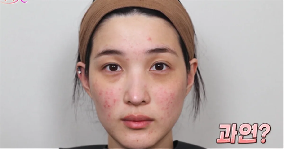 Former Laboum member Yulhee reveals skin changes after motherhood