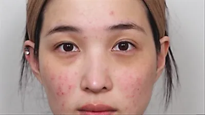 Former Laboum member Yulhee reveals skin changes after motherhood
