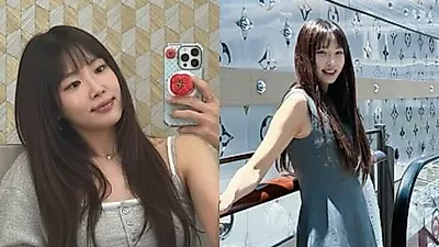 Kang Ye-won thay đổi diện mạo sau khi phẫu thuật phục hồi thẩm mỹ