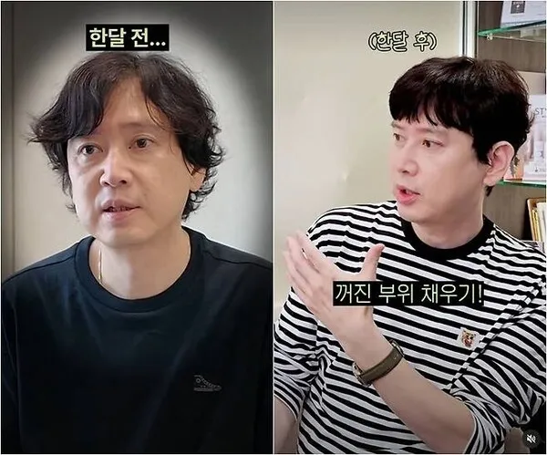 Original 'Flower Boy' Kim Jin Rejuvenated to His 30s After Anti-Aging Procedure at 53