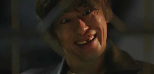 Gu Kyoohwan Loses Front Tooth in 'Mojamussa' – Ko Yoon-jung's Tearful Laughter