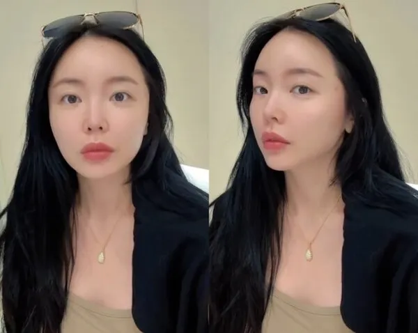 Hong Jin-young khoe nhan sắc rạng rỡ sau nửa năm chăm sóc da bằng laser
