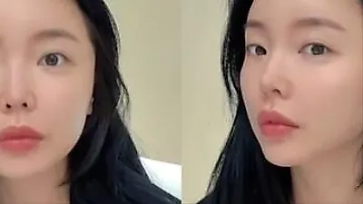 Hong Jin Young reveals skin treatment: 'Managing my skin after six months'
