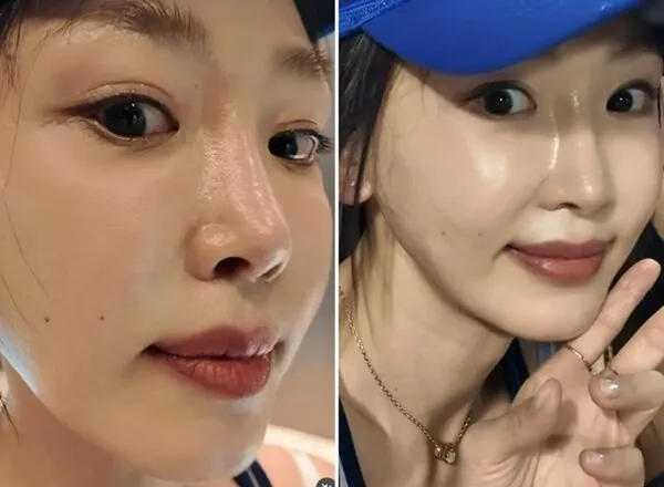 Kang Ye-won chia sẻ sau khi phục hồi mí mắt: 'Giờ tôi mới tìm lại được khuôn mặt mình'