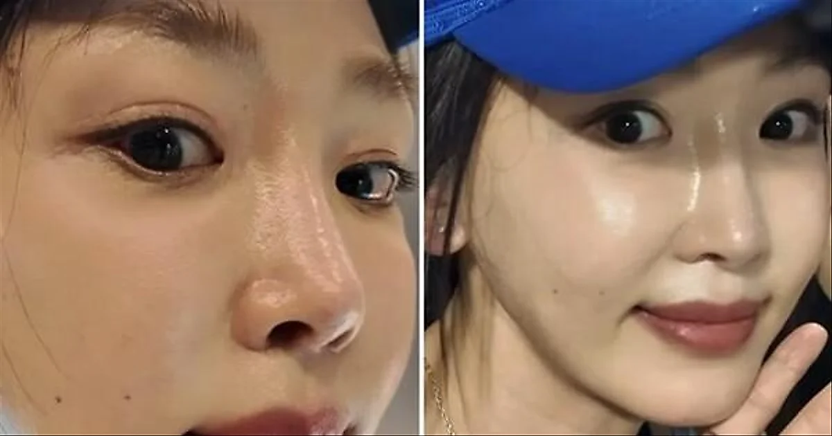 Kang Ye-won finds her true self after facial surgery