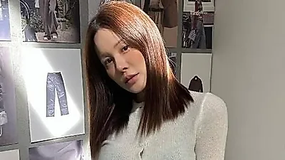Ivy tiet lo da lam thu thuat da lieu vi vung duoi mat bi hom: "Toi da 43 tuoi, vao tuoi t…