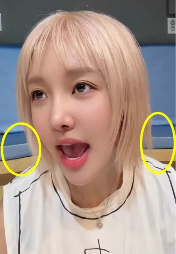 Ralral Reveals Body Changes After Childbirth—Is She Using 'Beauty Filters'?