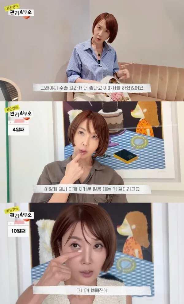 Choi Eun-kyung's Under-Eye Fat Removal: From Initial Regret to Total Satisfaction