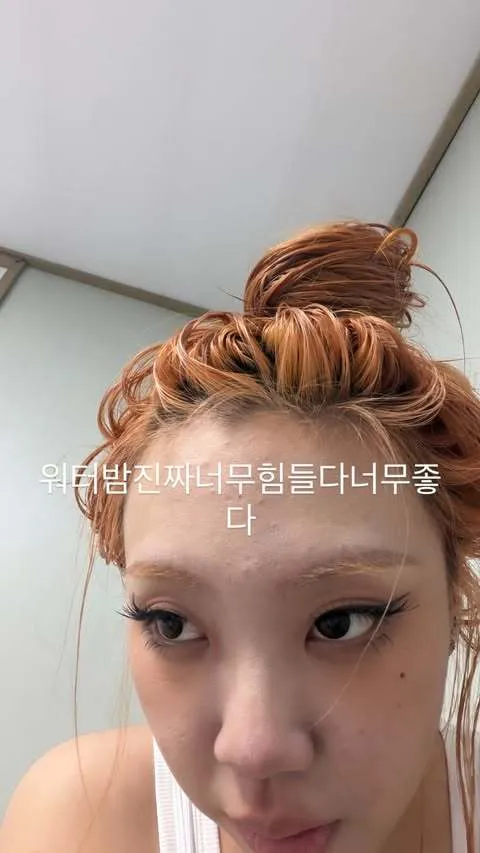 Lee Young-ji chia sẻ về việc phẫu thuật tái tạo mỡ dưới mắt: 'Dù rất mệt nhưng tôi thấy rất ổn' tại Waterbomb