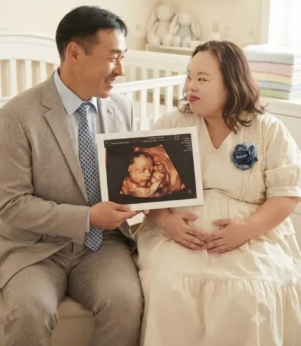 Seo Eun-hye, Diagnosed with Down Syndrome, Denies Pregnancy Rumors: 'We Agreed Not to Have Children'