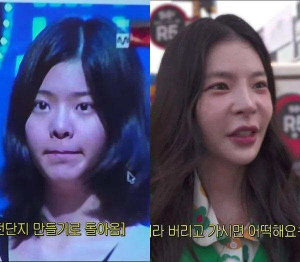 Jang Jae-in reacts to production team's plastic surgery allegations with 'Oh, my head'