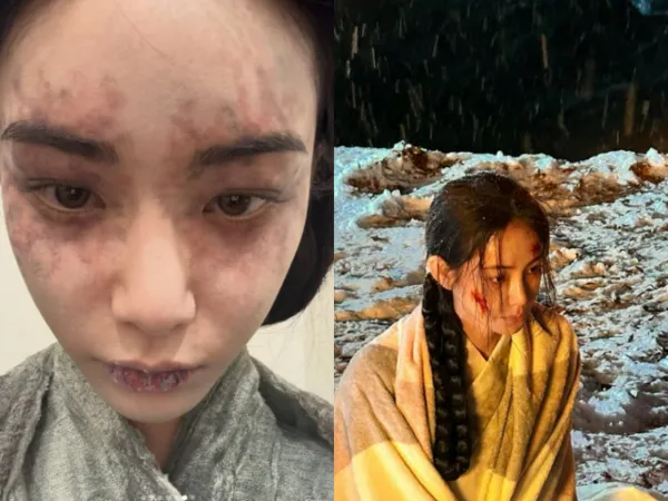 The Identity of the 'Pond Ghost' in 'Donggung' Revealed: Actress Hong Su-ju's Stunning Visual Transformation