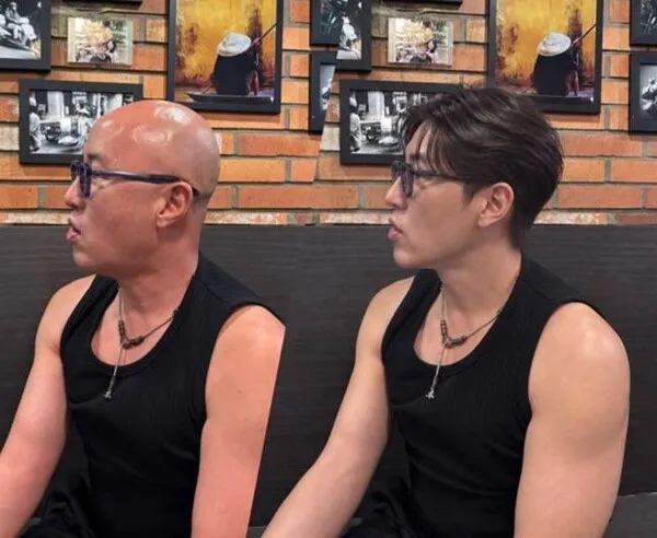 Hong Seok-cheon dự đoán màn trình diễn đội tóc giả sẽ thu hút thêm nhiều người xem
