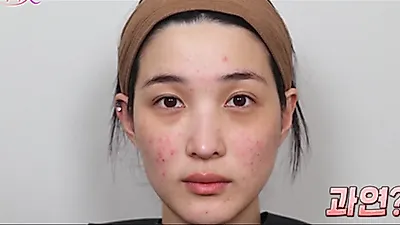 Former Laboum member Yulhee reveals skin changes after motherhood