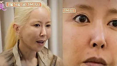 S.E.S. Suga reveals skin concerns on 'Beauty Clinic Touch Me'