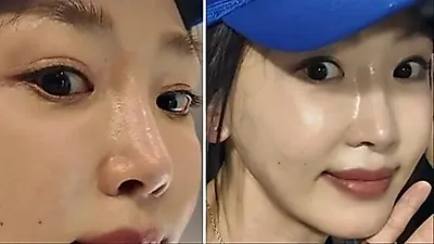 Kang Ye-won finds her true self after facial surgery