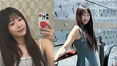 Kang Ye-won thay đổi diện mạo sau khi phẫu thuật phục hồi thẩm mỹ