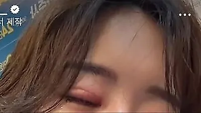 Lee So-ra sheds tears during solo Jeju Island trip after sudden medical procedure