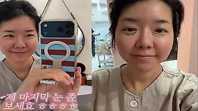Cats' Kim Ji-hye shares one-month update after under-eye surgery