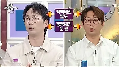 Lee Chang-ho mimics Kim Woo-bin after hair transplant and eye surgery