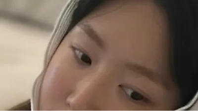 Kang Ye-won Rests with Compression Bandages After Revealing 7 Eye Surgeries