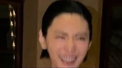 ナナ、唇の変化で再び注目。フィラー論争を経て「元の姿」へ？