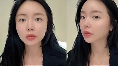Hong Jin Young reveals skin treatment: 'Managing my skin after six months'