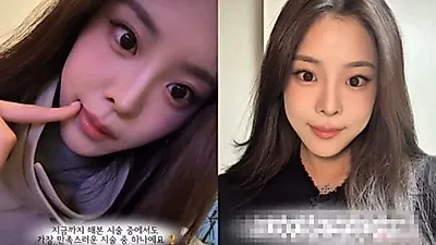 Miss Korea winner Woo Seo-yoon addresses appearance speculations with dental update