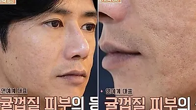 元イケメンClick-Bのオ・ジョンヒョクが語る没落「食道が溶け、全身に水疱が」
