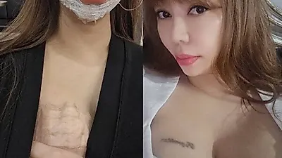 'I Am SOLO' star Choi Myeong-eun undergoes seventh chest tattoo removal