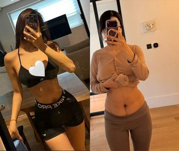 Ohttomom reveals sagging belly after second childbirth, "It's still soft"