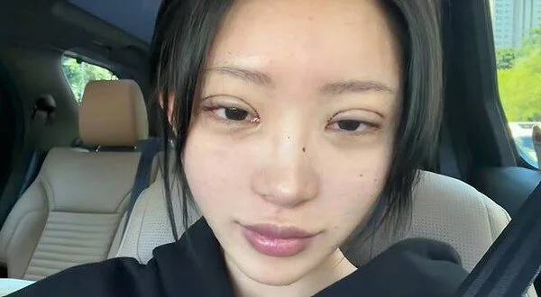 Choi Jun-hee reveals double eyelid revision surgery, says she cannot stop her obsession with…