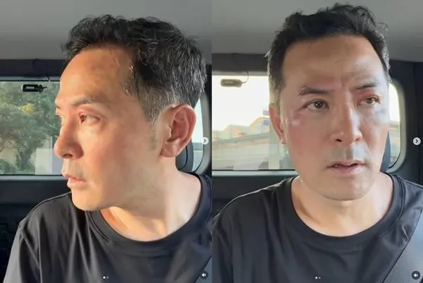 キム・チャンオク、顔がパンパンに腫れ「顔に客が来ましたね」と告白